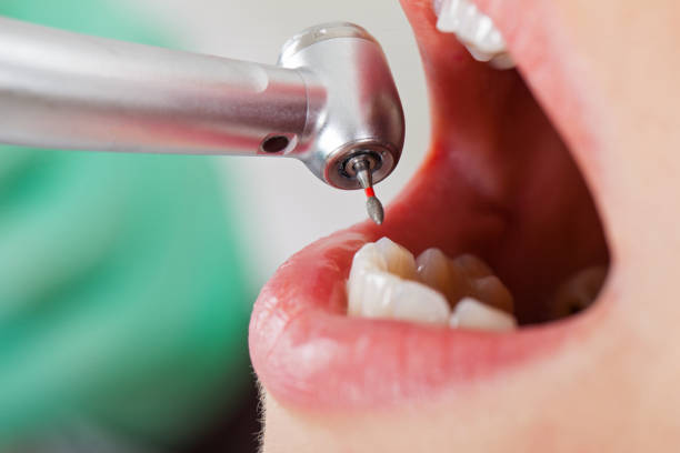 Best Urgent Dental Care for Toothache in Coing, AL